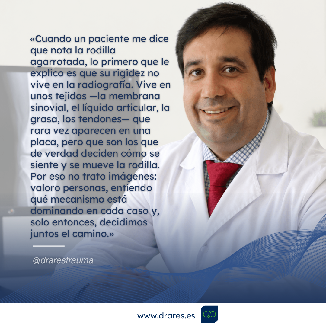 Tejidos blandos de la articulación de la rodilla implicados en el agarrotamiento